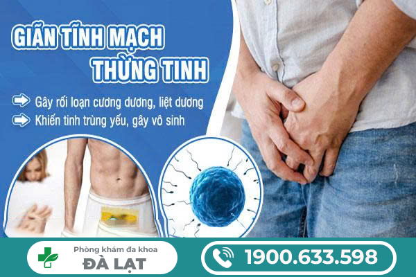 Hình ảnh minh họa